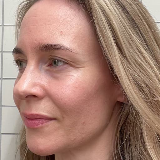 Photo Après d’une femme ayant pris The Solution, la poudre de collagène d’Oslo Skin Lab. Elle s’appelle Charlotte.