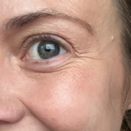 Photo Après d’une femme ayant pris The Solution, la poudre de collagène d’Oslo Skin Lab. Elle s’appelle Melissa.