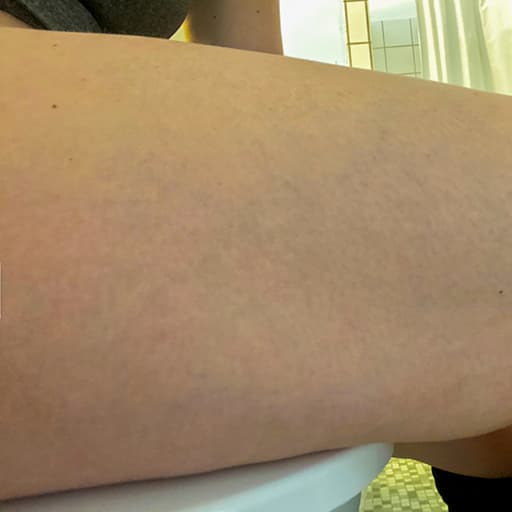 Photo Après d’une femme ayant pris The Solution, la poudre de collagène d’Oslo Skin Lab. Elle s’appelle Nadia.