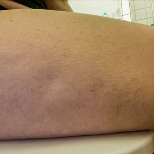 Photo d’une femme avant d'avoir pris The Solution, la poudre de collagène d’Oslo Skin Lab. Elle s’appelle Nadia