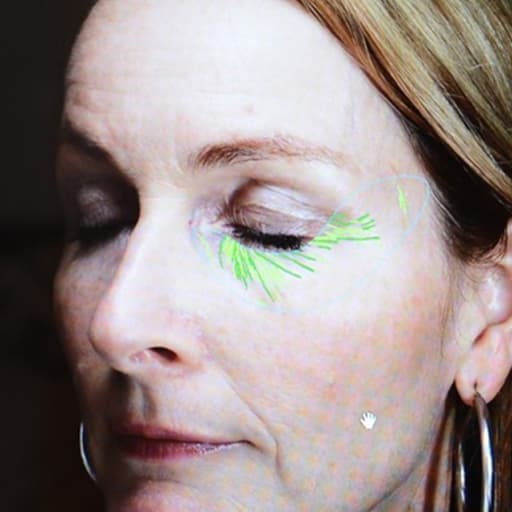 Photo d'une femme avant de commencer à prendre The Solution, la poudre de collagène d’Oslo Skin Lab.  Elle s’appelle Heidi.